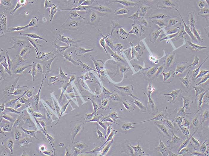 HCMEC/D3人脑微血管内皮细胞（永生化）（STR鉴定正确）