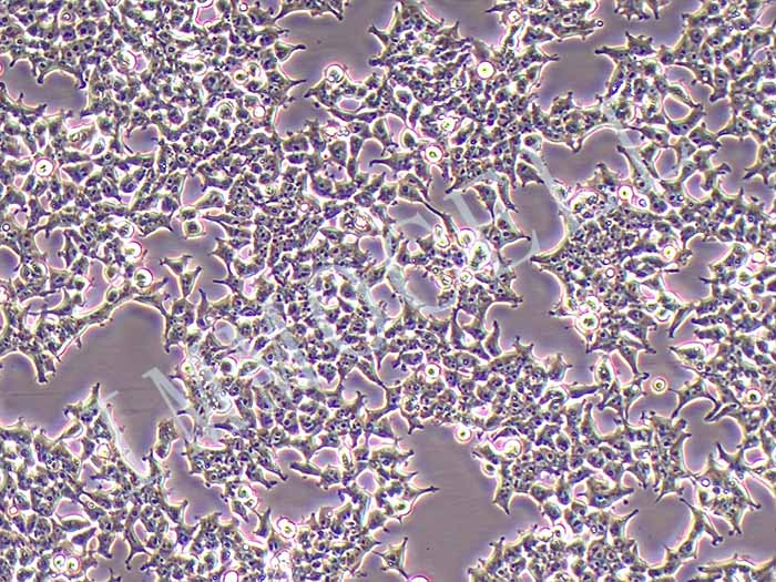 293T/17人胚肾细胞