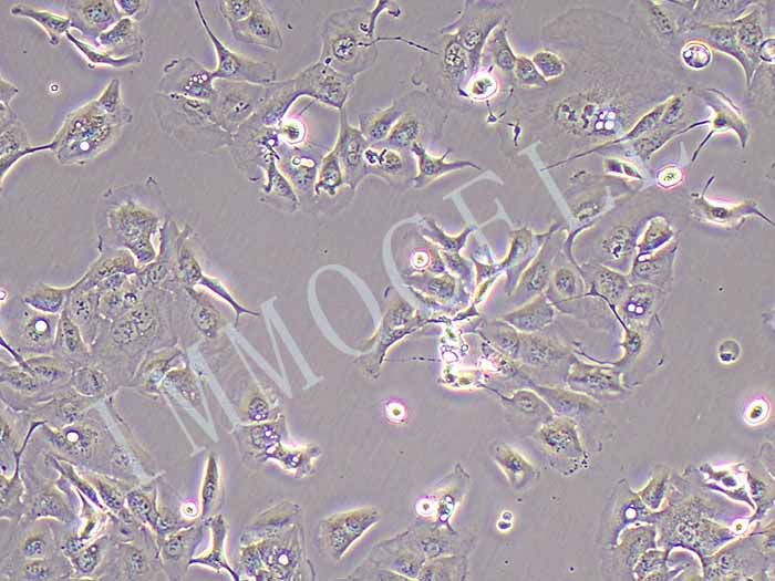 RBE人肝胆管癌细胞 (STR鉴定正确)