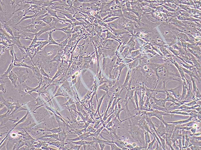 小鼠骨髓间充质干细胞（永生化）