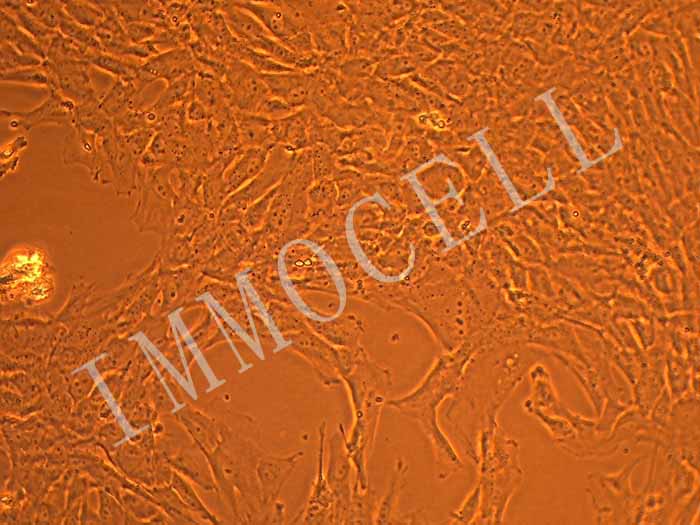 CCC-ESF-1人胚皮肤成纤维细胞