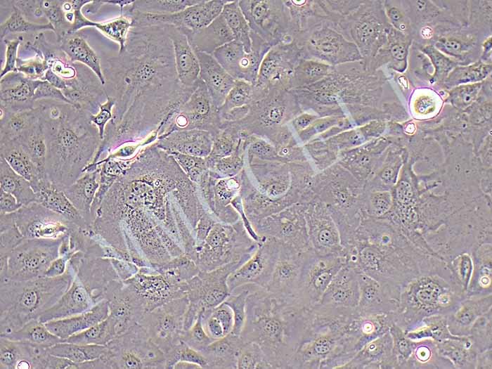 SKOV3/DDP人卵巢癌细胞顺铂耐药株