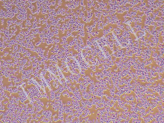 RAW264.7小鼠单核巨噬细胞白血病细胞（STR鉴定正确）