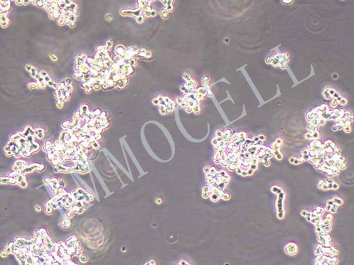 y79人视网膜母细胞瘤细胞