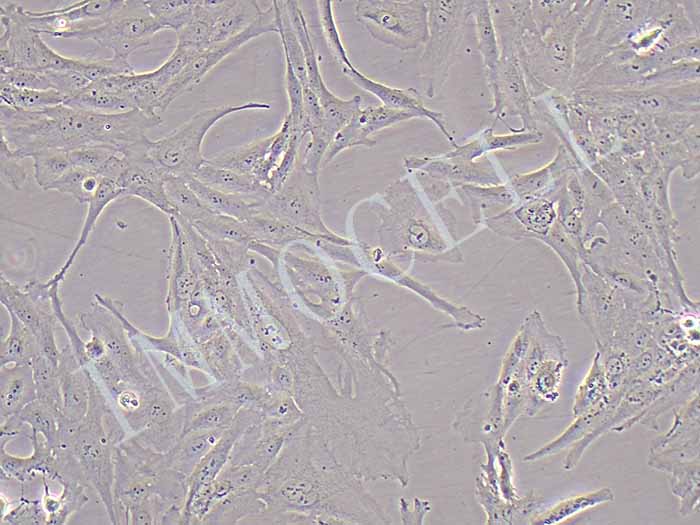 SW1353人软骨肉瘤细胞（STR鉴定正确）