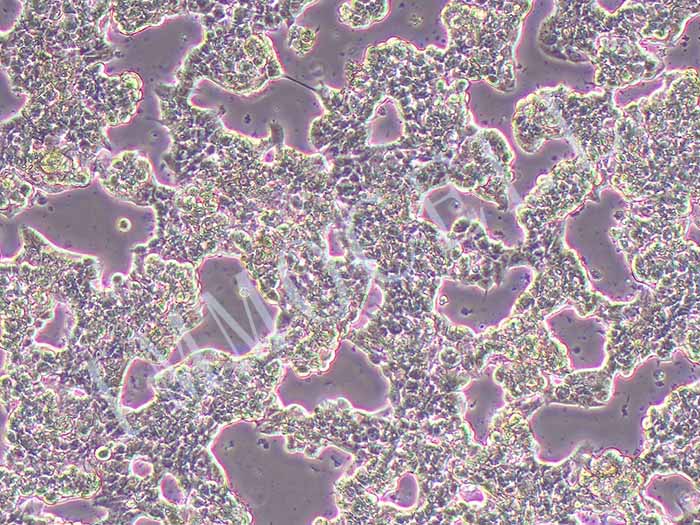 ZR-75-1人乳腺癌细胞（STR鉴定正确）