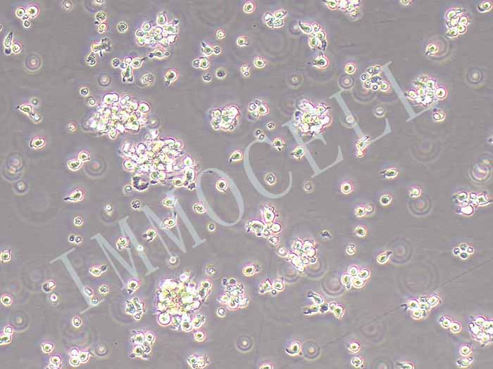 SU-DHL-4人B淋巴瘤细胞