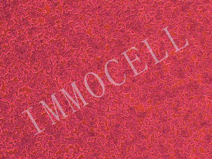 CT26-FLUC-puro小鼠结肠癌细胞(FLUC标记)（STR鉴定）