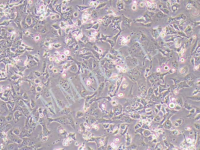 Het-1A人食道正常细胞（STR鉴定正确）