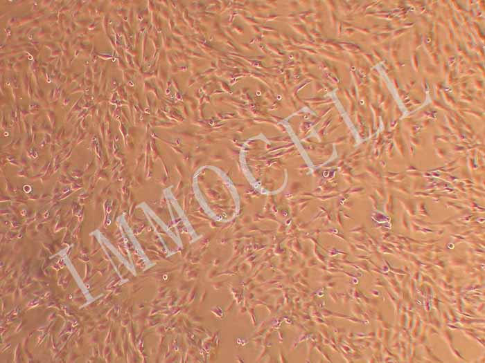 人软骨细胞（永生化）