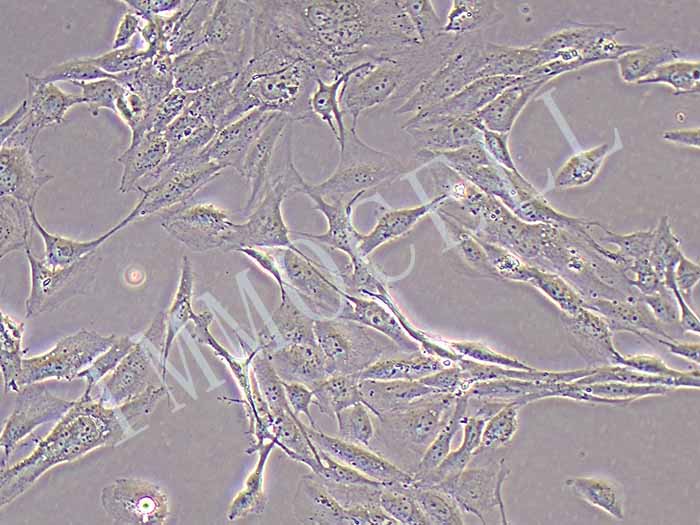 HFOB1.19人SV40转染成骨细胞（暂不提供）
