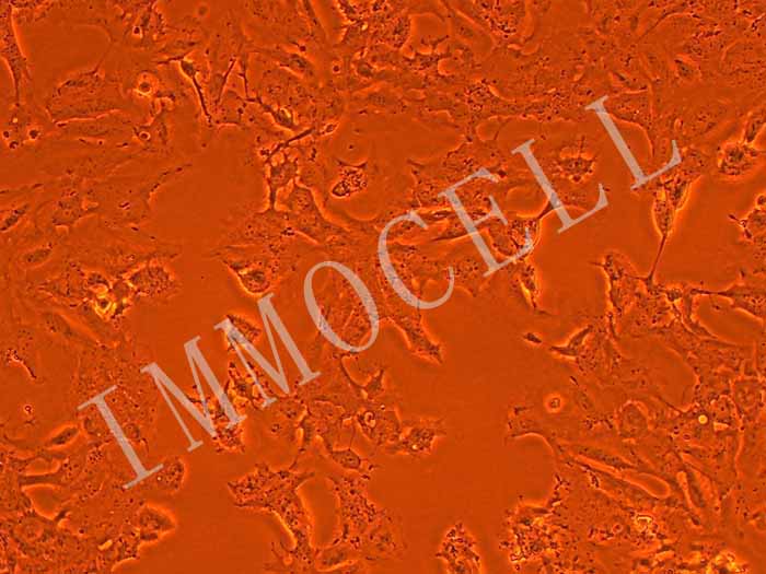 HFSF人胚胎眼巩膜成纤维细胞（暂不供应）