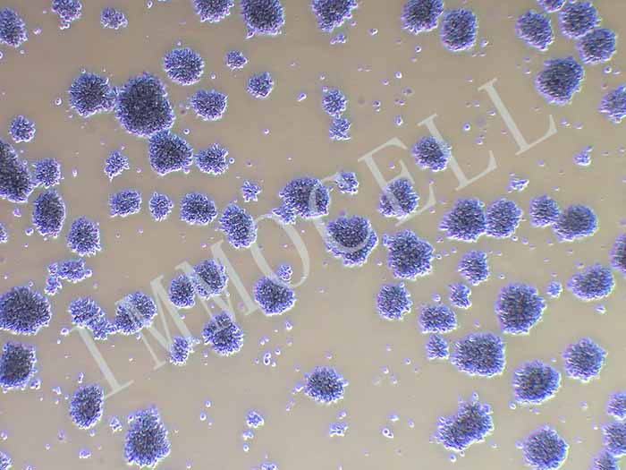 MT-4人急性淋巴母细胞白血病细胞（STR鉴定正确）