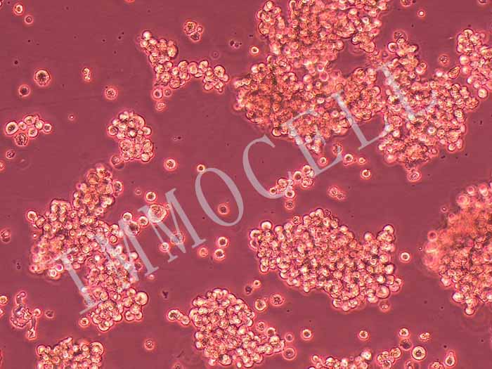 Hut-78人T淋巴细胞白血病细胞（STR鉴定正确）