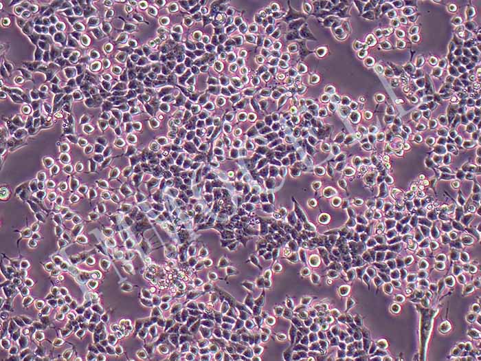 E0771小鼠乳腺癌细胞