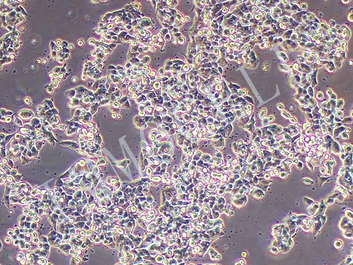 CW2人结肠癌细胞（STR鉴定正确）