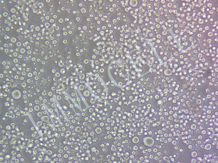 HBL-1-FLUC-puro人弥漫大B淋巴瘤细胞(FLUC标记)（暂不提供）