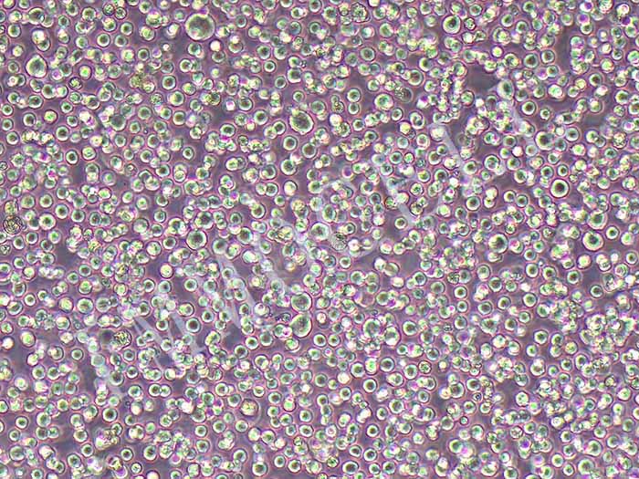 HBL-1人弥漫大B淋巴瘤细胞（暂不提供）
