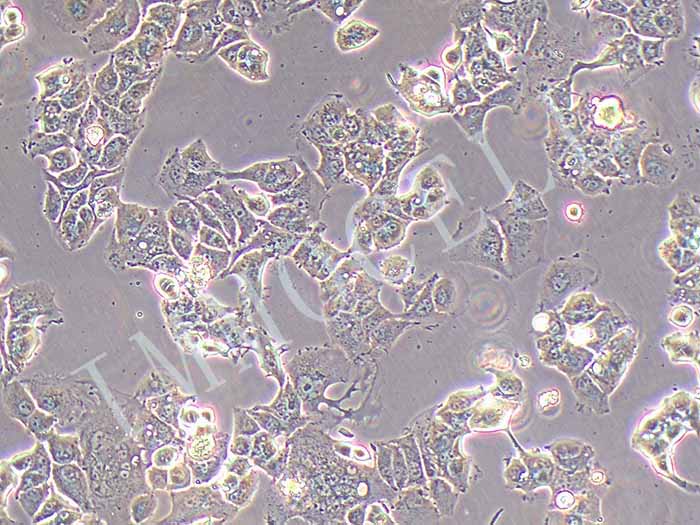 MHCC97-L人低转移肝癌细胞（STR鉴定）