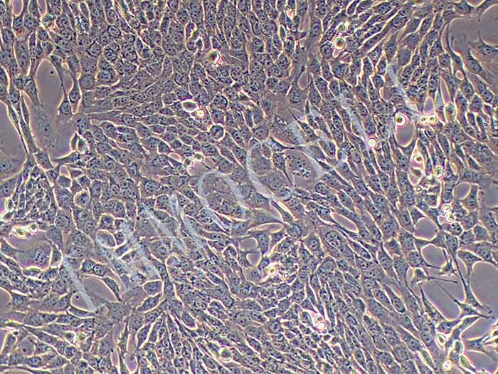 NIH:OVCAR-8	人卵巢癌腺癌细胞