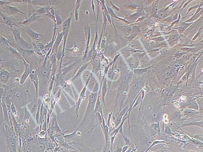 人肠息肉上皮细胞（永生化）