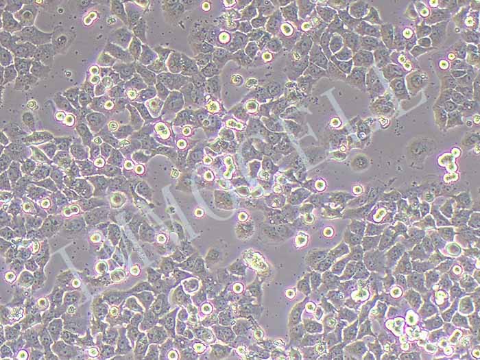 Caov3-FLUC-puro人卵巢癌细胞(FLUC标记)