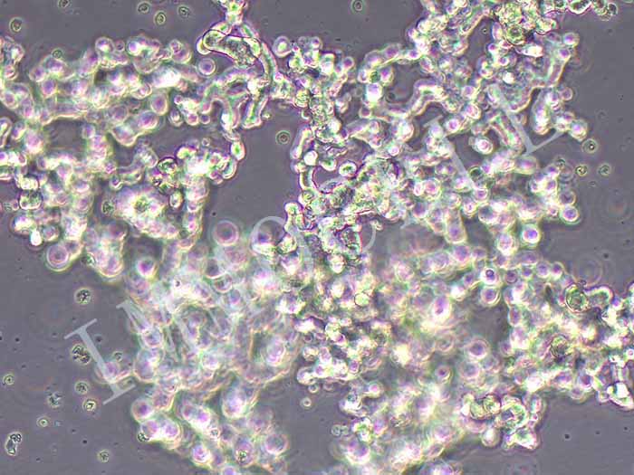 DU4475人乳腺上皮细胞（STR鉴定正确）
