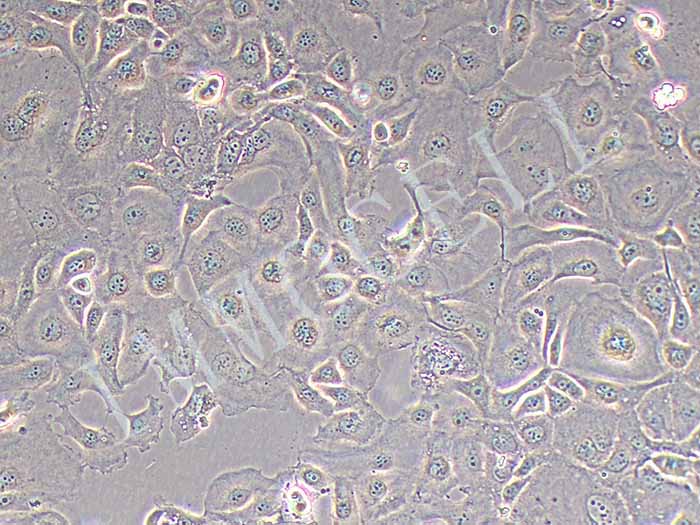 KLE人子宫内膜癌细胞（STR鉴定正确）