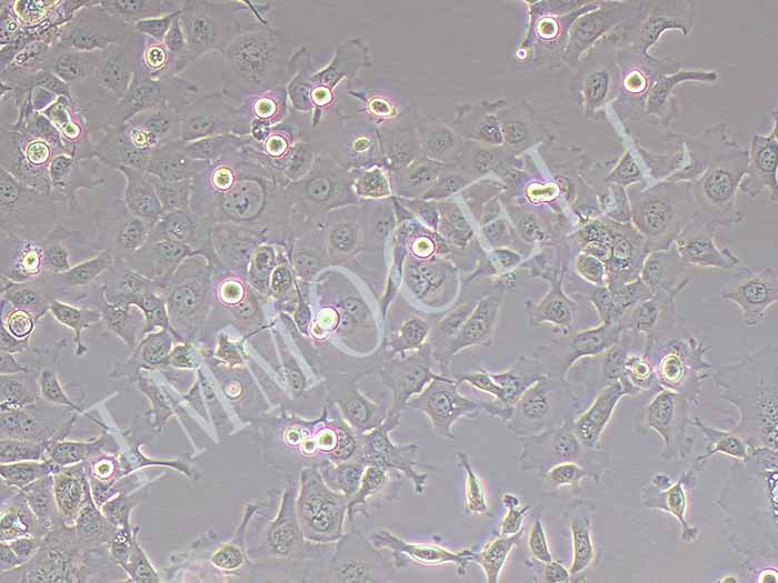 KYSE-410 人食管鳞癌细胞（STR鉴定正确）
