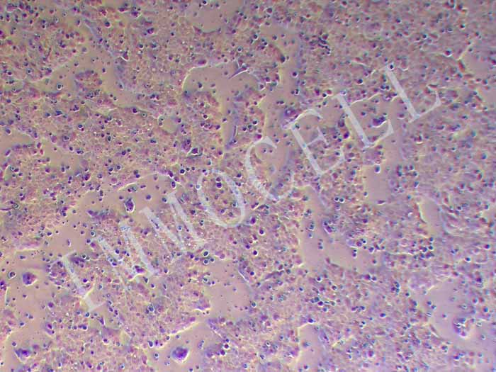 TE-13人食管癌细胞（暂不提供）