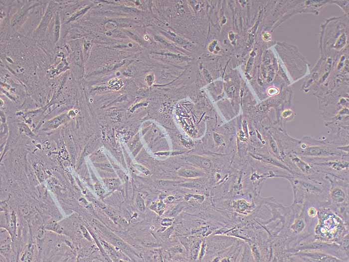A7R5大鼠胸大动脉平滑肌细胞