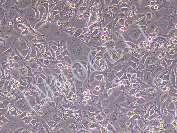 G422小鼠神经胶质瘤细胞