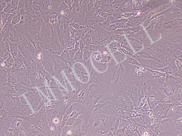MEF小鼠胚胎成纤维细胞永生化