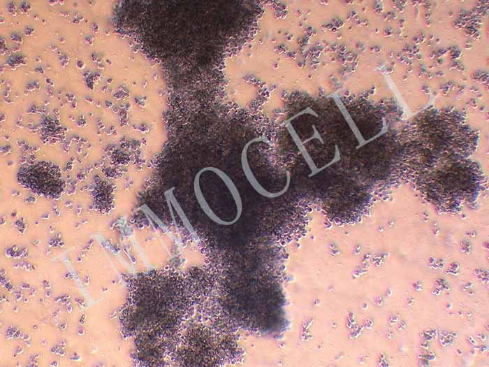 NK-92MI人恶性非霍奇金淋巴瘤患者的自然杀伤细胞（STR鉴定正确）