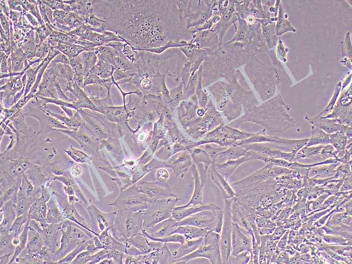 U87-MG-FLUC-puro脑胶质瘤细胞(FLUC标记)
