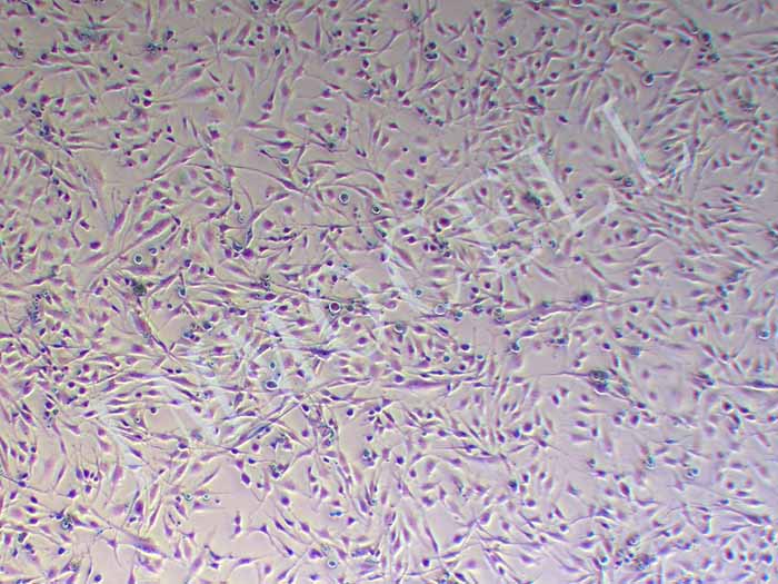 U251MG-FLUC-puro人类星型胶质瘤细胞(FLUC标记)（STR鉴定正确）