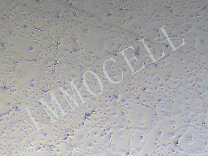 MKN7-FLUC-puro人胃癌细胞(FLUC标记)