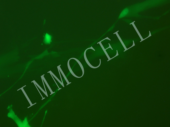 MSC-FLUC-eGFP-puro人脐带间充质干细胞(FLUC/eGFP双标)