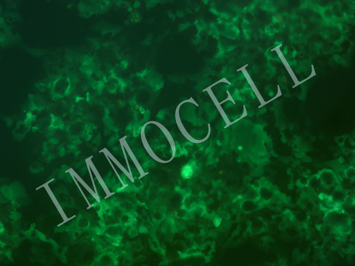 NCI-N87-FLUC-eGFP-puro人胃癌细胞(FLUC/eGFP双标)