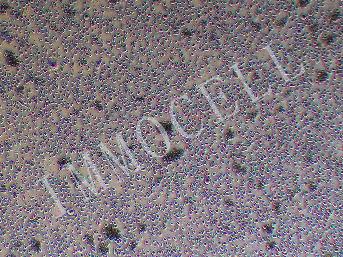 TF-1人红系白血病细胞（STR鉴定正确）