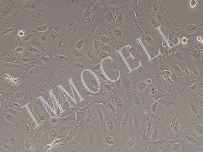 94T778人高分化脂肪肉瘤细胞