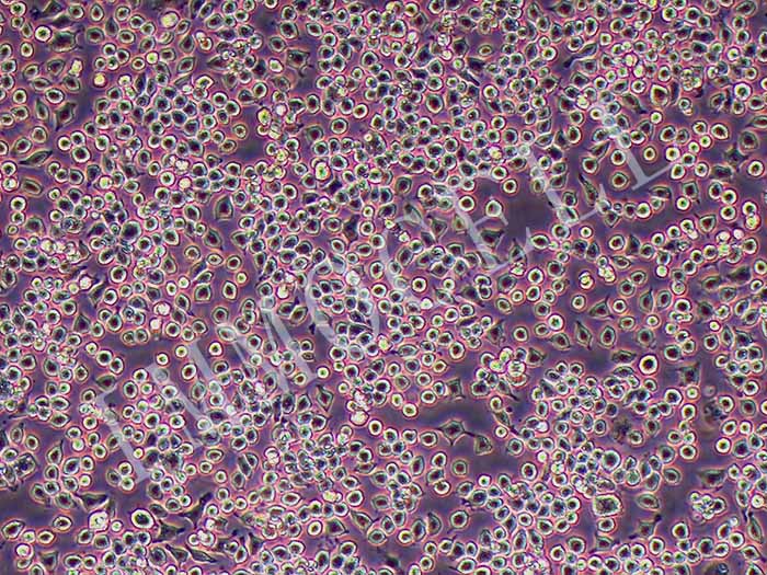 J774A.1小鼠单核巨噬细胞（STR鉴定正确）