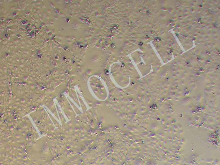 HuCCT1人胆管癌细胞（STR鉴定正确）