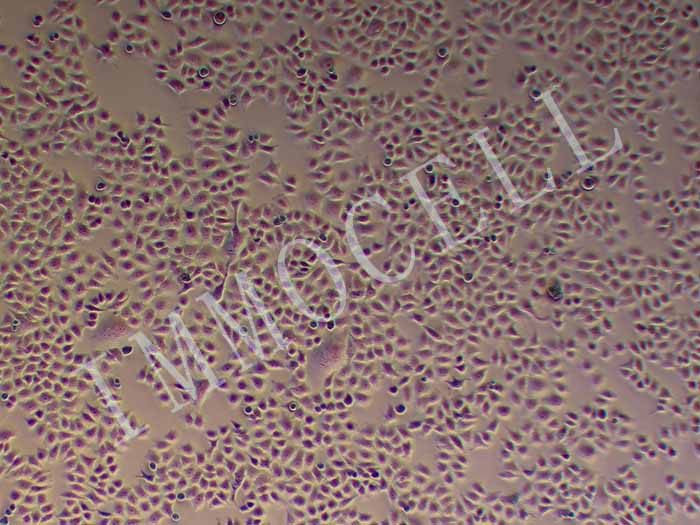 HELA S3人宫颈癌细胞（STR鉴定正确）