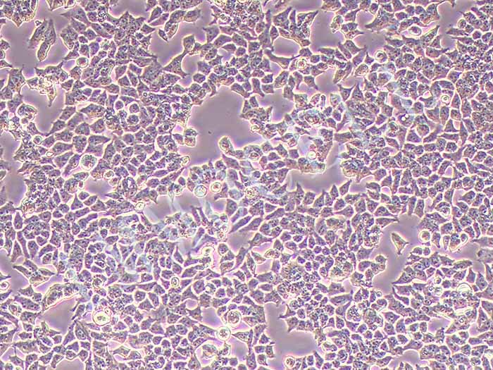 PC3-FLUC-bsd人前列腺癌细胞(FLUC标记)