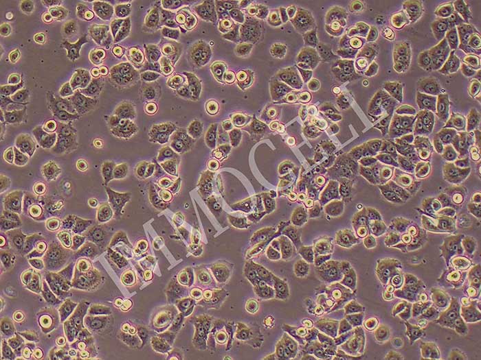 NCI-H2126人肺癌细胞（STR鉴定正确）