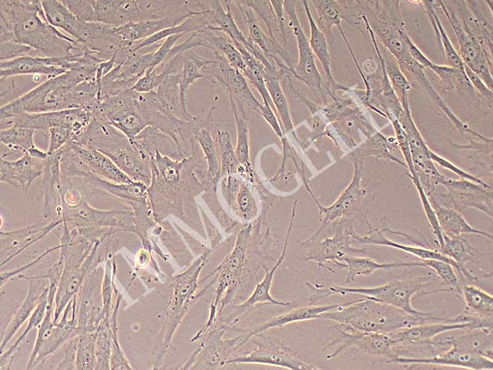 HTMC人眼小梁网细胞（暂不提供）