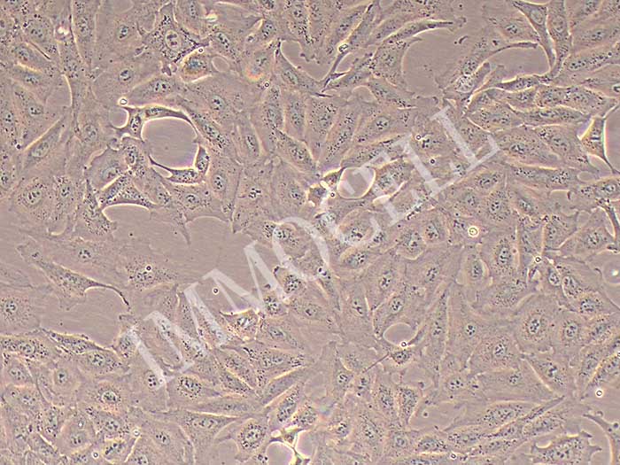 A875人黑色素瘤细胞（STR鉴定正确）