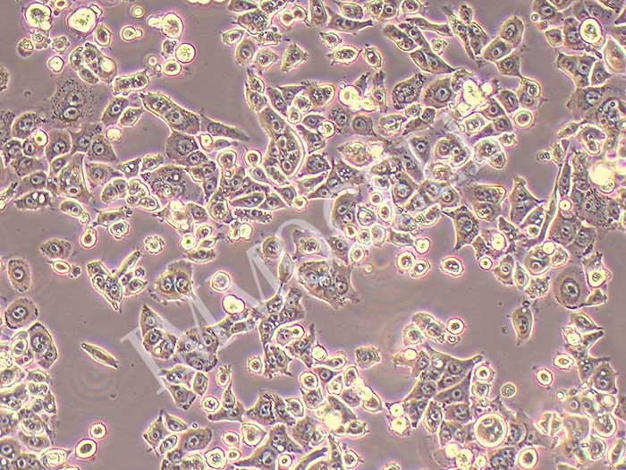 GCIY人胃癌细胞（STR鉴定正确）