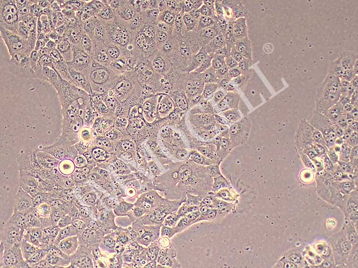 NCI-H441人肺腺癌细胞(STR鉴定正确)